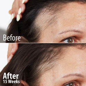 Age Reverse Collagen